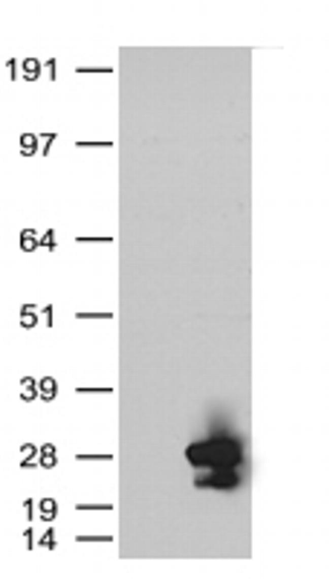 KRAS Antibody in Western Blot (WB)