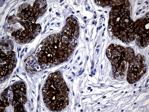 KRT14 Antibody in Immunohistochemistry (Paraffin) (IHC (P))