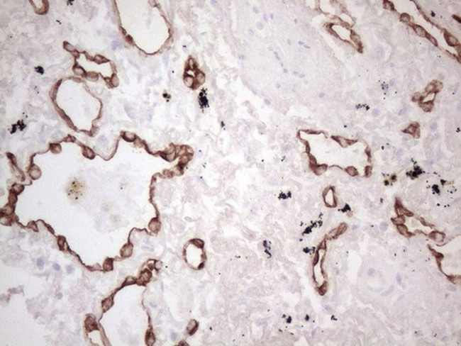 KRT16 Antibody in Immunohistochemistry (Paraffin) (IHC (P))