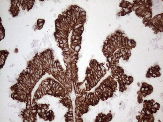 KRT16 Antibody in Immunohistochemistry (Paraffin) (IHC (P))