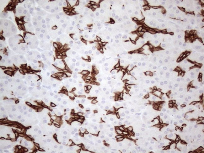 KRT16 Antibody in Immunohistochemistry (Paraffin) (IHC (P))