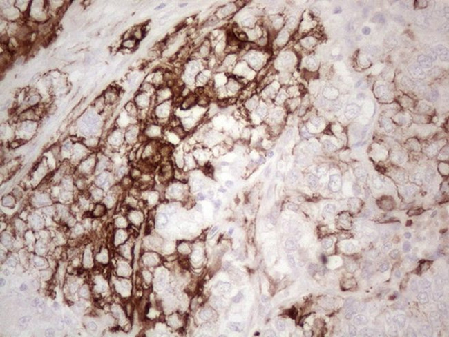 KRT16 Antibody in Immunohistochemistry (Paraffin) (IHC (P))