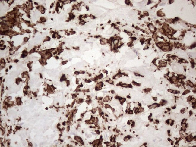 KRT16 Antibody in Immunohistochemistry (Paraffin) (IHC (P))