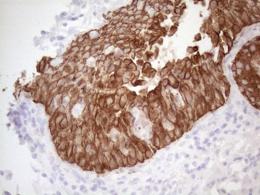 KRT16 Antibody in Immunohistochemistry (Paraffin) (IHC (P))