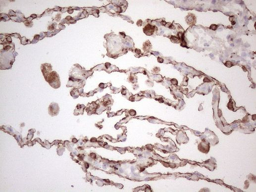 KRT16 Antibody in Immunohistochemistry (Paraffin) (IHC (P))