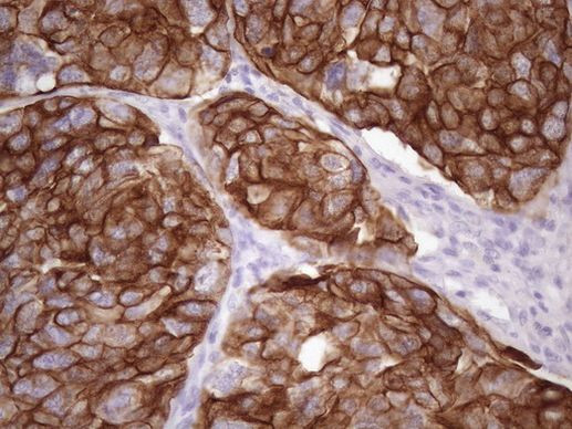 KRT16 Antibody in Immunohistochemistry (Paraffin) (IHC (P))