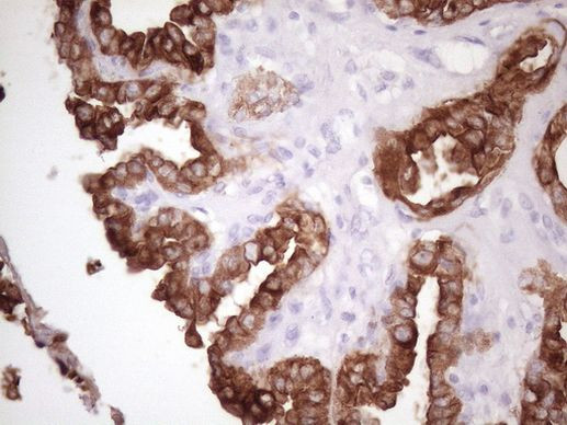 KRT16 Antibody in Immunohistochemistry (Paraffin) (IHC (P))