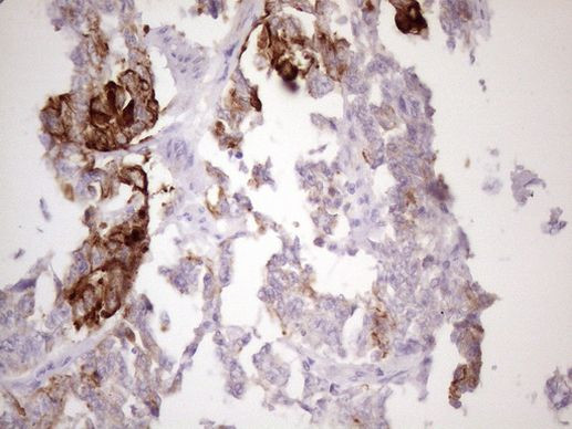 KRT16 Antibody in Immunohistochemistry (Paraffin) (IHC (P))