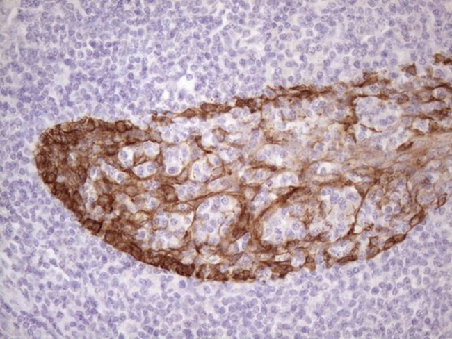 KRT16 Antibody in Immunohistochemistry (Paraffin) (IHC (P))