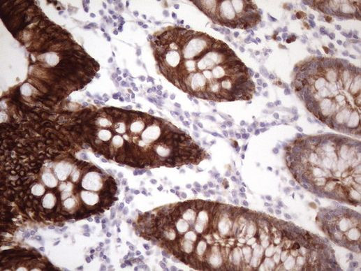 KRT16 Antibody in Immunohistochemistry (Paraffin) (IHC (P))