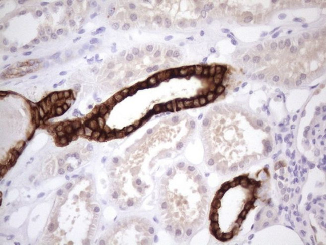 KRT16 Antibody in Immunohistochemistry (Paraffin) (IHC (P))