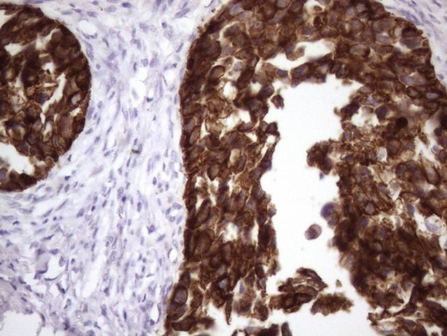 KRT16 Antibody in Immunohistochemistry (Paraffin) (IHC (P))