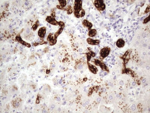 KRT16 Antibody in Immunohistochemistry (Paraffin) (IHC (P))