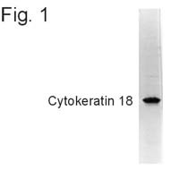 Cytokeratin 18 Antibody in Western Blot (WB)