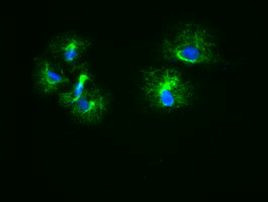 KRT18 Antibody in Immunocytochemistry (ICC/IF)