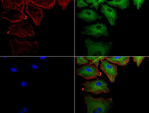 KRT18 Antibody in Immunocytochemistry (ICC/IF)