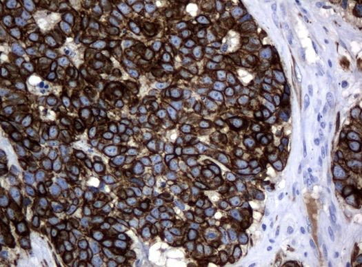 KRT18 Antibody in Immunohistochemistry (Paraffin) (IHC (P))