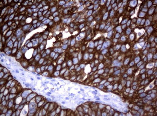 KRT18 Antibody in Immunohistochemistry (Paraffin) (IHC (P))