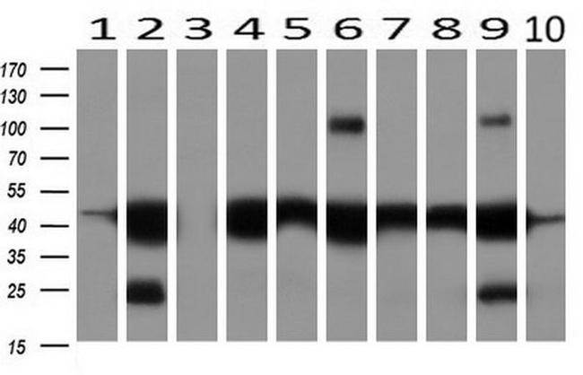 KRT18 Antibody in Western Blot (WB)