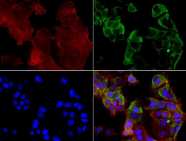 KRT19 Antibody in Immunocytochemistry (ICC/IF)