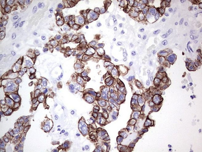 KRT19 Antibody in Immunohistochemistry (Paraffin) (IHC (P))