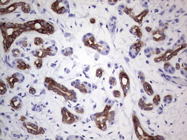 KRT19 Antibody in Immunohistochemistry (Paraffin) (IHC (P))