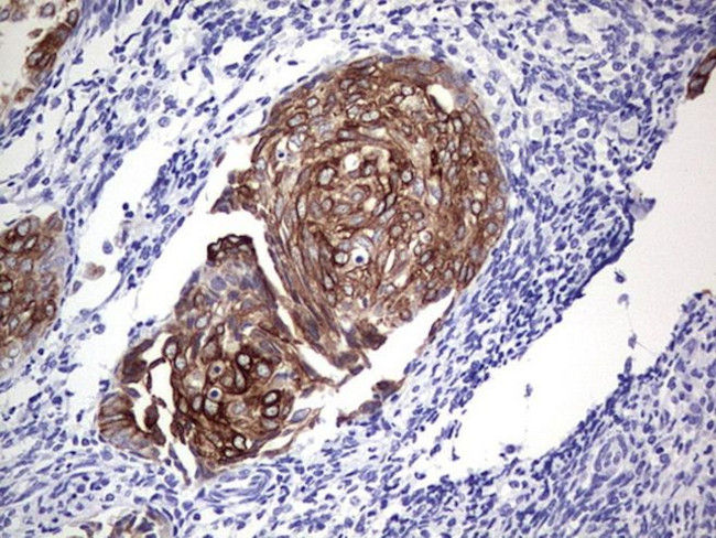 KRT19 Antibody in Immunohistochemistry (Paraffin) (IHC (P))