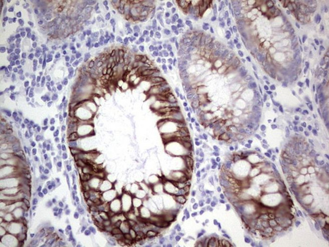 KRT19 Antibody in Immunohistochemistry (Paraffin) (IHC (P))