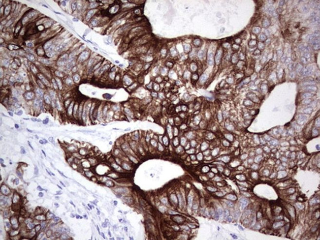 KRT19 Antibody in Immunohistochemistry (Paraffin) (IHC (P))