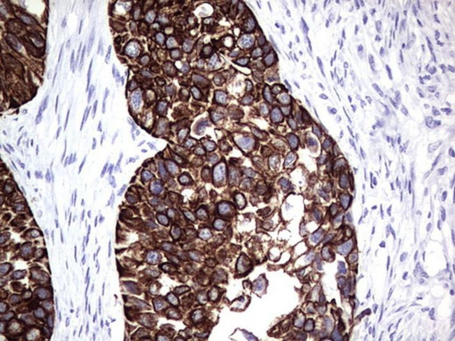 KRT19 Antibody in Immunohistochemistry (Paraffin) (IHC (P))