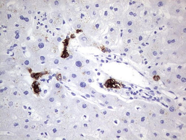 KRT19 Antibody in Immunohistochemistry (Paraffin) (IHC (P))