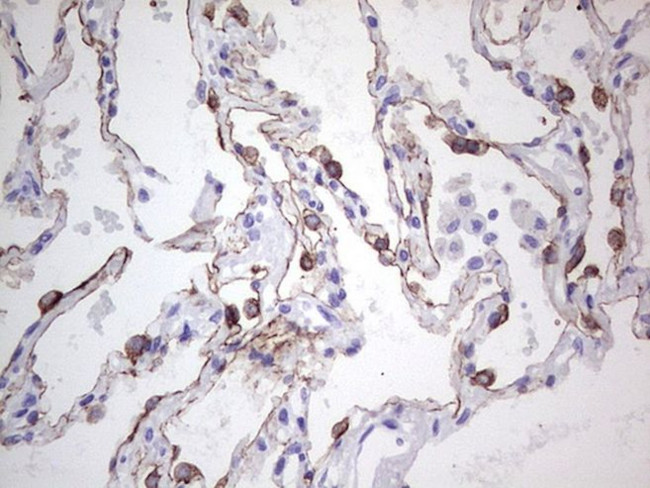 KRT19 Antibody in Immunohistochemistry (Paraffin) (IHC (P))