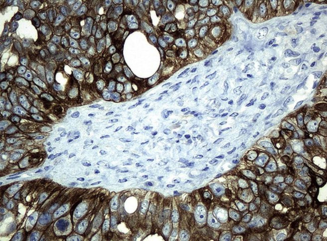 KRT19 Antibody in Immunohistochemistry (Paraffin) (IHC (P))