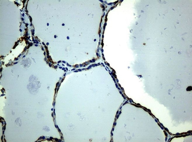 KRT19 Antibody in Immunohistochemistry (Paraffin) (IHC (P))