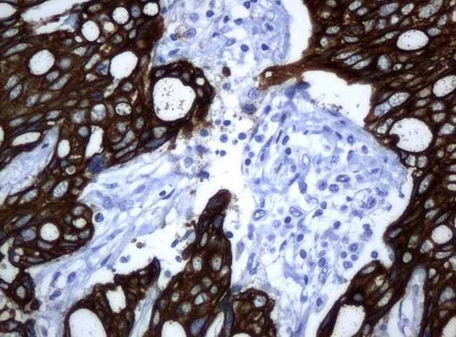 KRT19 Antibody in Immunohistochemistry (Paraffin) (IHC (P))