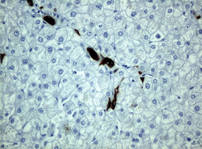 KRT19 Antibody in Immunohistochemistry (Paraffin) (IHC (P))