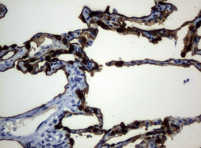 KRT19 Antibody in Immunohistochemistry (Paraffin) (IHC (P))