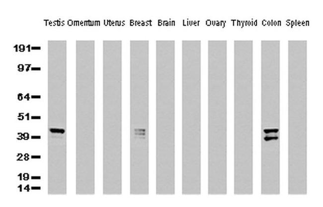 KRT19 Antibody in Western Blot (WB)