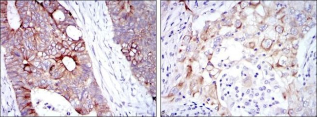 Cytokeratin 19 Antibody in Immunohistochemistry (Paraffin) (IHC (P))