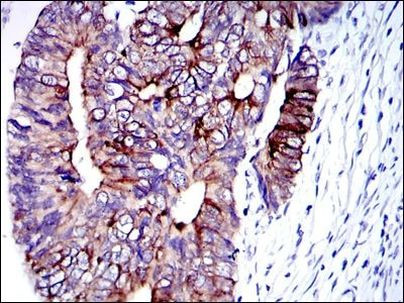 Cytokeratin 19 Antibody in Immunohistochemistry (Paraffin) (IHC (P))