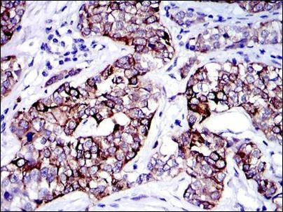 Cytokeratin 19 Antibody in Immunohistochemistry (Paraffin) (IHC (P))