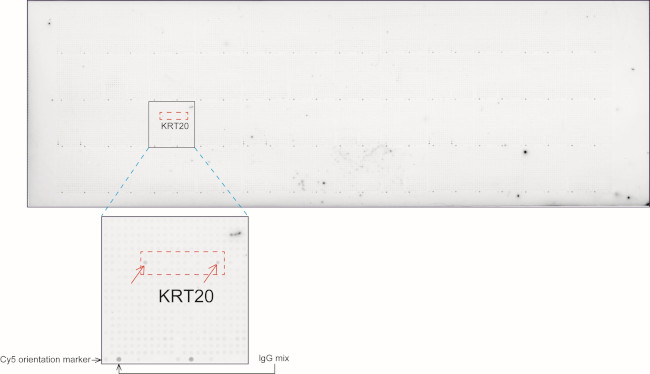 KRT20 Antibody in Peptide array (ARRAY)