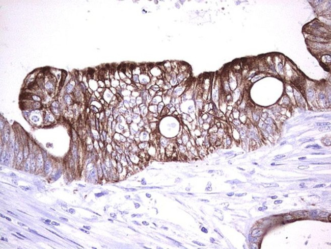 KRT20 Antibody in Immunohistochemistry (Paraffin) (IHC (P))