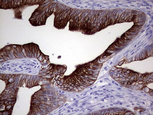 KRT20 Antibody in Immunohistochemistry (Paraffin) (IHC (P))