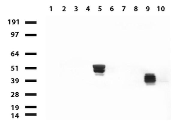 KRT20 Antibody in Western Blot (WB)