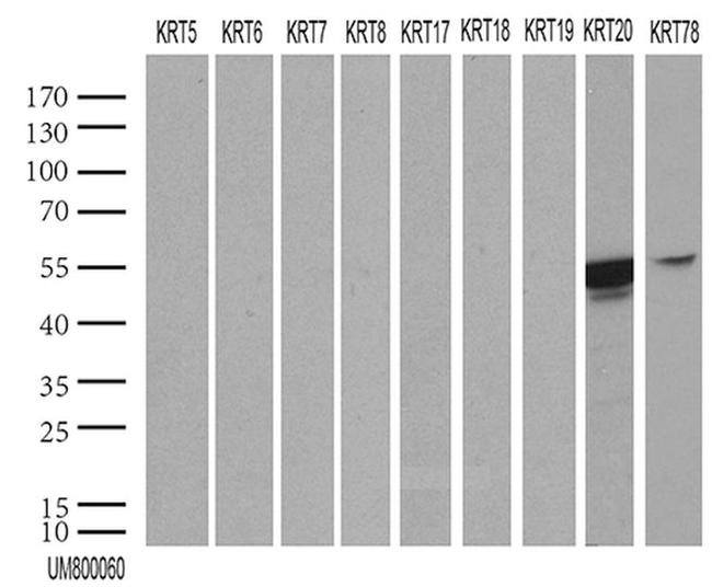 KRT20 Antibody in Western Blot (WB)
