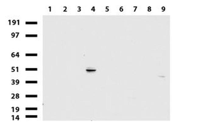 KRT20 Antibody in Western Blot (WB)