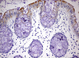 KRT24 Antibody in Immunohistochemistry (Paraffin) (IHC (P))