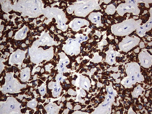 KRT24 Antibody in Immunohistochemistry (Paraffin) (IHC (P))