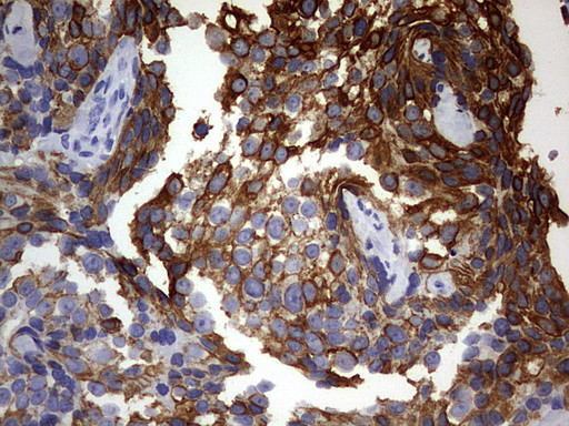 KRT24 Antibody in Immunohistochemistry (Paraffin) (IHC (P))